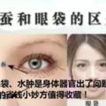 黑眼圈、眼袋、水腫是身體器官出了問題？5個去眼疾的省錢小妙方值得收藏！