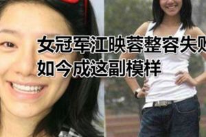 女冠軍江映蓉整容失敗，如今成這副模樣