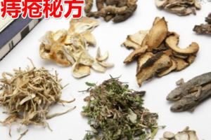 痔瘡秘方：用它治療痔瘡，輕松對痔瘡說再見！