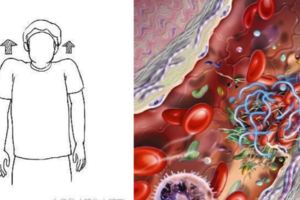 五類人易被血栓「拴住」，一個小動作，「沖洗」血管，遠離血栓！