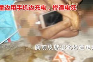 7歲童邊玩手機邊充電胸前皮膚溶化慘遭電死