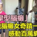 4歲腦癱女奇蹟一小步感動百萬網友