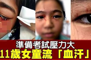 考前讀書壓力大　11歲女童竟流「血汗」