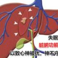 失眠很煩惱？醫生：每天吃這種水果、常按這三處穴位，一覺到天亮