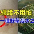 爸爸生蛇纏腰特別嚇人，婆婆用一種野草泡水立刻搞定！分享給需要的人！