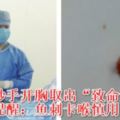 哈醫大腫瘤醫院醫生妙手開胸取出「致命魚刺」專家提醒：魚刺卡喉慎用民間方法