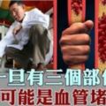 身體這3個部位一旦開始疼痛，很可能是血管堵了！這「4件事情」，以後盡量少做！