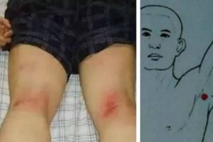 十人九濕？身體七個「排污口」，每天拍一拍，排出濕毒，一身輕松