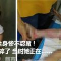 2歲女兒全身慘不忍睹！家長心都碎了當時她正在……