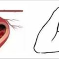 血管堵沒堵，撓撓腋窩就知道，一撓一個准，血管堵塞再也不用輸液