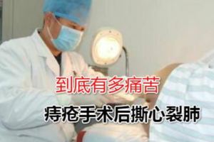痔瘡手術到底有多痛苦，分享我手術親身經歷，讓你身臨其境
