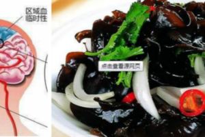 頸動脈最易堵！頸動脈斑塊怎麼治療？有哪些清血管的必吃神器？