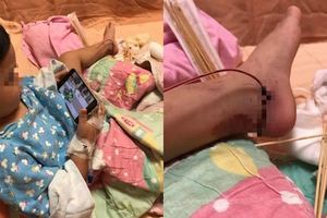 「腳踝肉炸開…」2歲女兒腳捲入車輪媽心痛發文籲