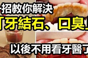 「牙結石口臭難消除？」教你簡單天然辦法，不必看醫生，牙結石譁譁往下掉！