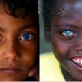 2個擁有『夢幻藍眼』的孩子，一個被親人當成惡魔，一個被富豪高價求購！