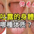 舌頭吐露的身體秘密：你是哪種體質？快看看吧！