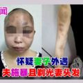 「戴綠帽」疑妻外遇被打至鼻青臉腫，夫還剃光妻子的頭髮