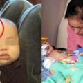 1歲寶寶總是愛摸頭，醫生檢查後表示很嚴重，父母自責：早當回事就好了！
