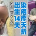 女嬰遭「死亡之吻」　出生14天染皰疹夭折!