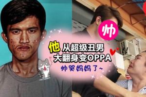 泰醜男大翻身變OPPA 整形醫生神出手,讓他3個月後「人生砍掉重練」!帥到老媽認不出兒子大哭~