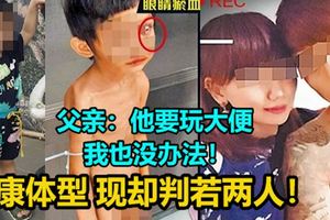 【3歲男童遭虐案】男童先前生活照可見健康的體型，現在卻判若兩人！父親：他要玩大便，我也沒辦法！