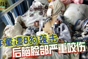 女童遭8狗襲擊後腦臉部嚴重咬傷