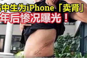 一生全毀！高中生為iPhone「賣腎」7年後慘況曝光