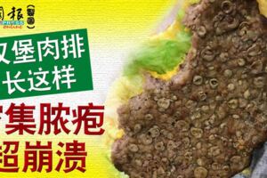 豬瘟疫情影響？漢堡肉排長這樣，密集膿皰超崩潰，你敢吃嗎？