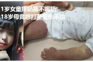 1歲女童摔奶瓶不喝奶18歲母竟怒打至重傷不治