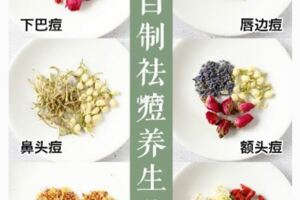 【自製祛痘茶】內調外養，痘痘全消失❗️