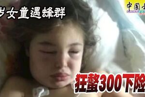 7歲女童遇蜂群狂螫300下休克送醫急救保一命