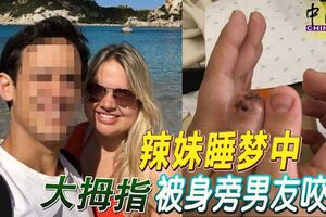 辣妹睡夢中大拇指　被身旁男友咬斷