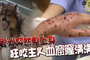 愛犬突然鬼上身狂咬主人「血窟窿」滿滿