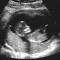 醫生發現來婦產科的17歲小女生已經懷孕14週，但看著超音波圖「恭喜」兩個字卻說不出口…