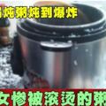 氣壓鍋燉粥燉到爆炸女慘被滾燙的粥毀容