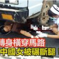 突然轉身橫穿馬路！卡車剎車不及！中國女被碾斷腿！