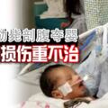 孕婦遭勒斃剖腹奪嬰寶寶腦損傷重不治