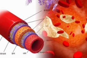 你知道嗎？6種「方法」能夠幫血管洗澡，讓你的血管回到18歲般強健...