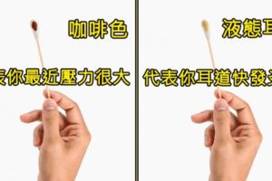 你最近挖完耳朵的「棉花棒是什麼顏色」？診斷你的身體到底出了什麼問題