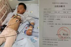 家長曝8歲兒子因沒寫完作業被3名課代表扇40耳光