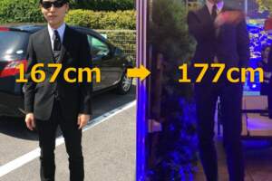 167→177！實習男醫師咬牙動「斷腿增高手術」　一圓高挑型男夢