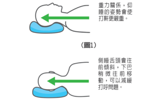 打呼、背痛、胃食道逆流 這些睡姿讓問題更嚴重