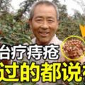 用「花椒」治療痔瘡，一治一個准，試過的都說「神」！