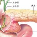 哪些食物吃多了會導致胰腺炎？該怎麼飲食預防？消化科醫師告訴你