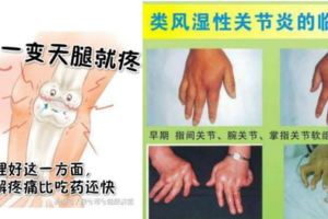 一變天腿就疼，只要調理好這一方面，緩解疼痛比吃藥還快