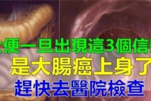 腫瘤專家的警告：大便出現這3個訊號，可是大腸癌！！！