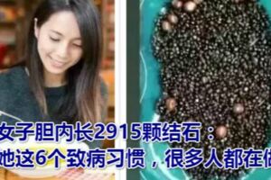 女子膽內長2915顆結石：她這6個致病習慣，很多人都在做！