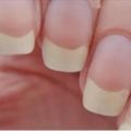 指甲上的月牙越少，身體越不健康？其實是…指甲出現這「8種」狀況要小心！