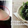 【脖子後面長了個富貴包】中醫叫我去買點黃豆，沒想到竟然治好了