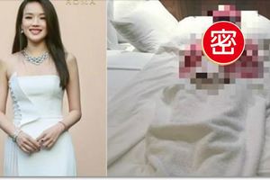 恐怖！舒淇傳出「生病」現在竟變成「這個樣」慘被完全隔離，照片曝光讓粉絲心疼辛苦了...